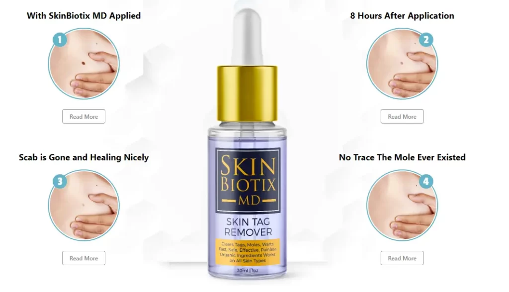 Skinfinity Skin Tag Remover-how-it-works